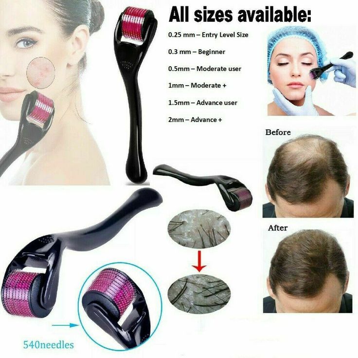 Derma Roller